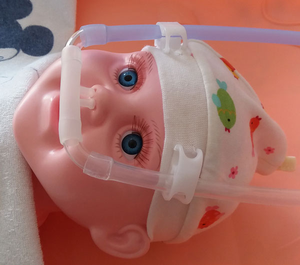 家用小兒CPAP呼吸機（氣管/喉軟骨軟化、氣道狹窄）